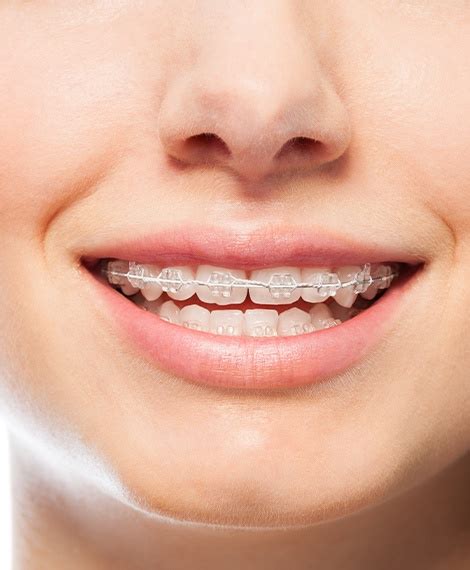 Solutions for Patients Unhappy with Their Orthodontic Results.